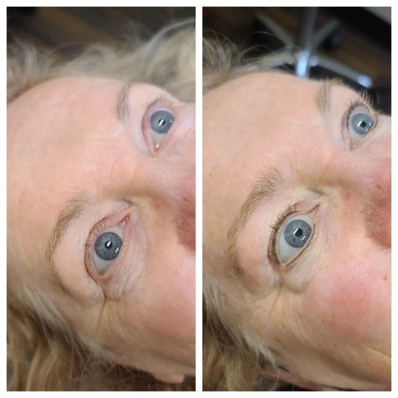 Before and After 10