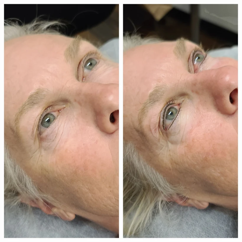 Before and After 21