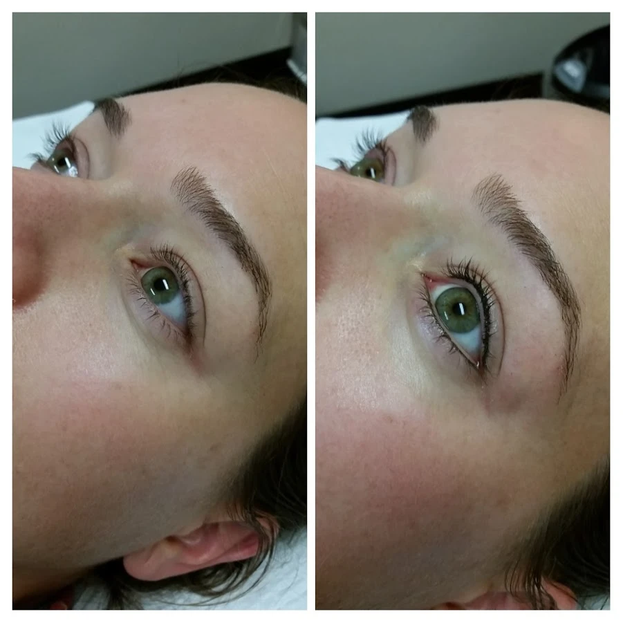Before and After 14