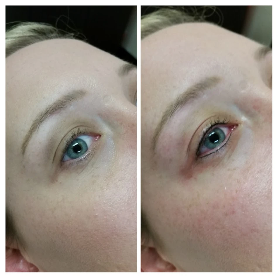 Before and After 15