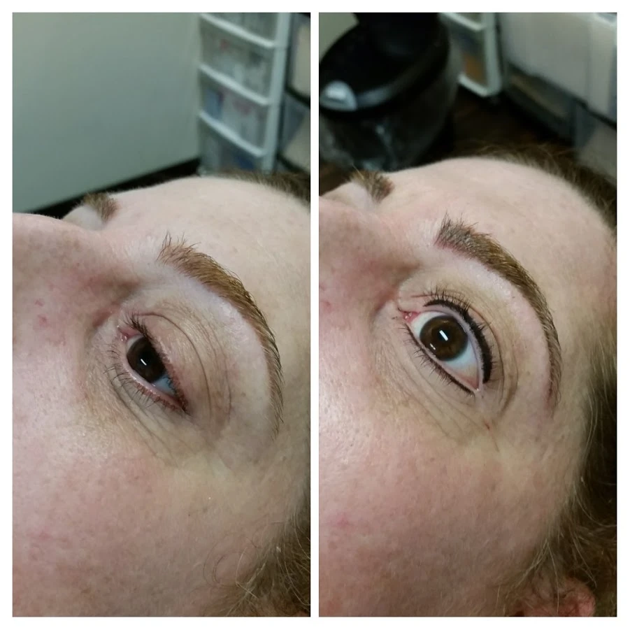 Before and After 13