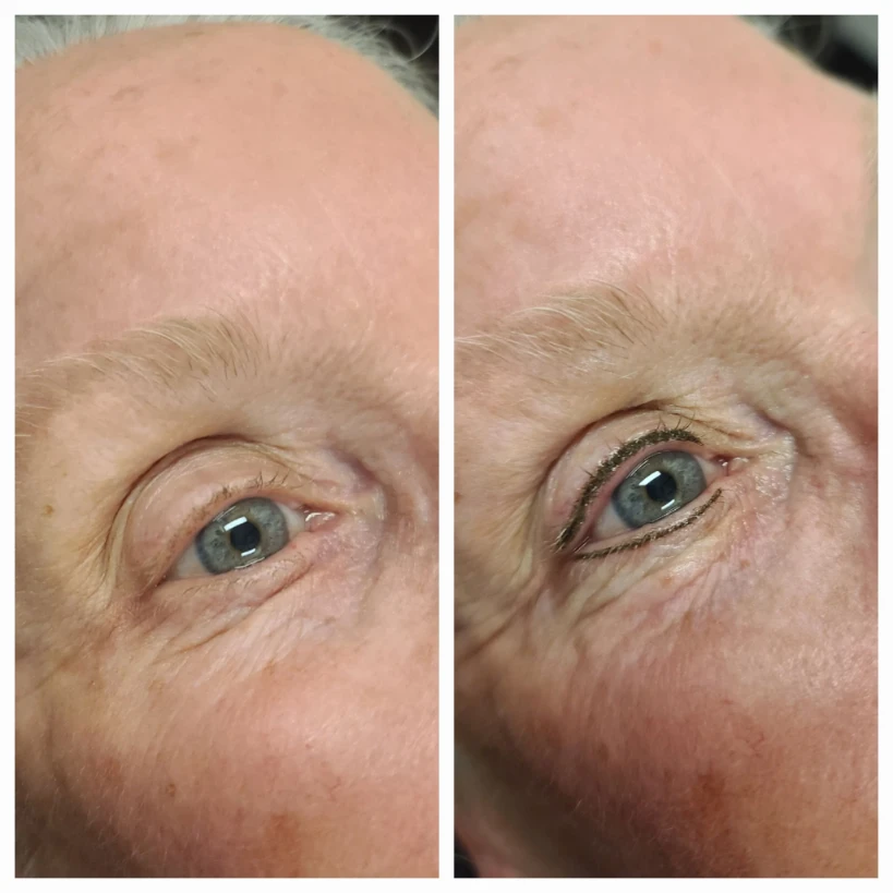 Before and After 19