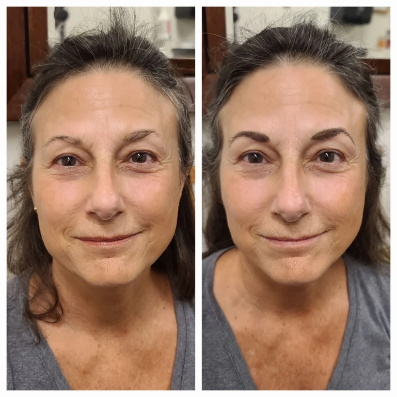 Before and After 9