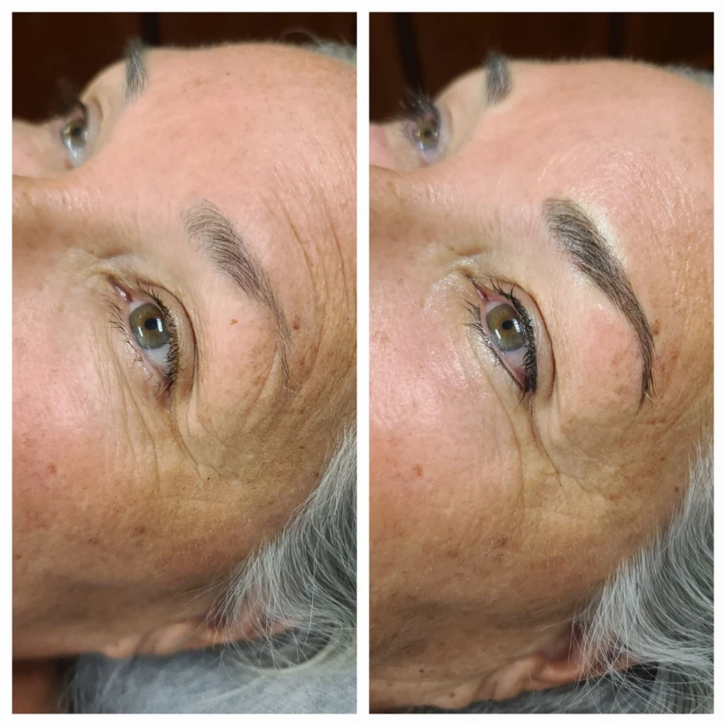 Before and After 2