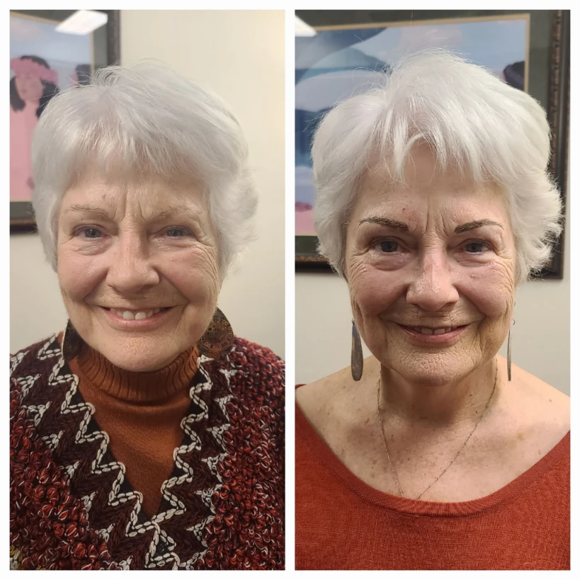 Before and After 16