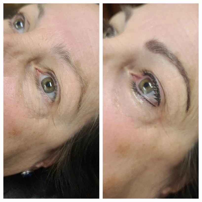Before and After 20
