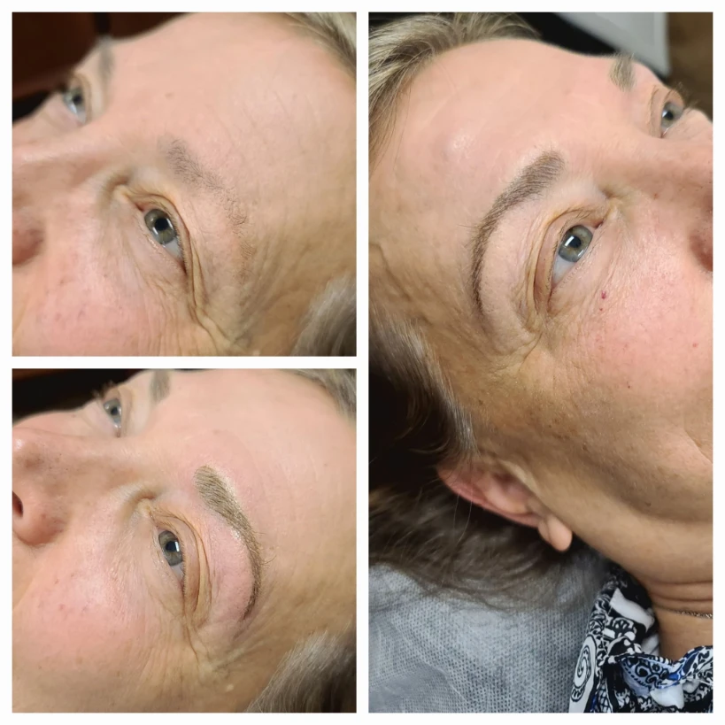 Before and After 17