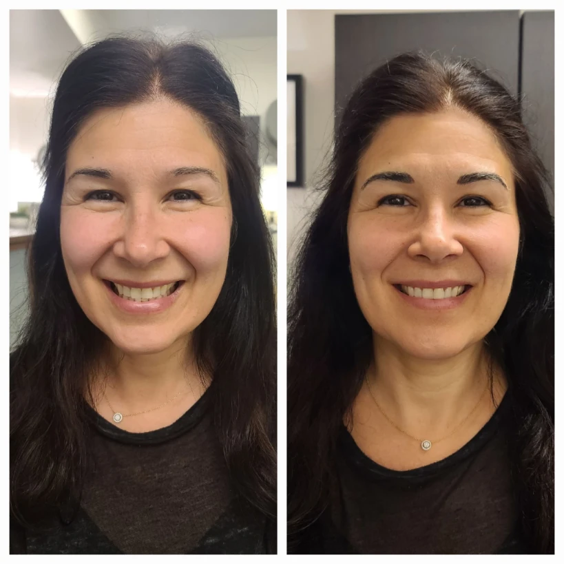 Before and After 24
