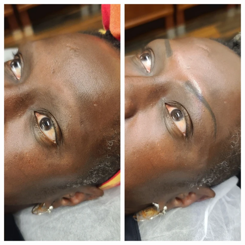 Before and After 12