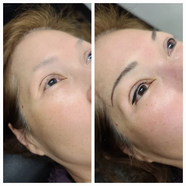 Before and After 8