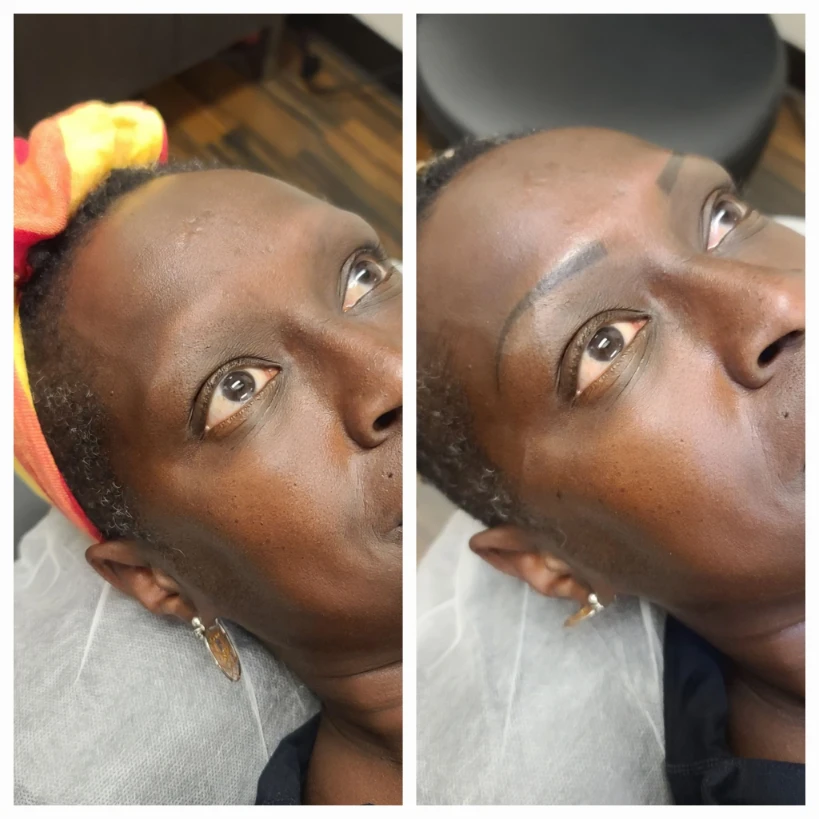 Before and After 18