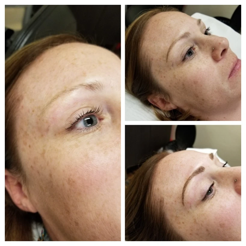Before and After 4