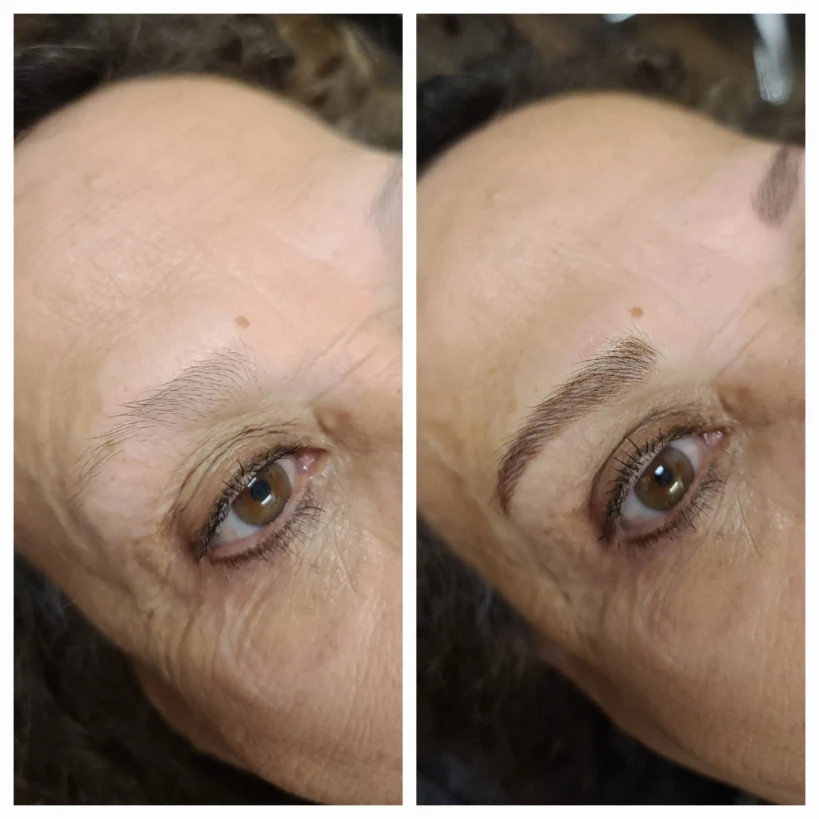 Before and After 5