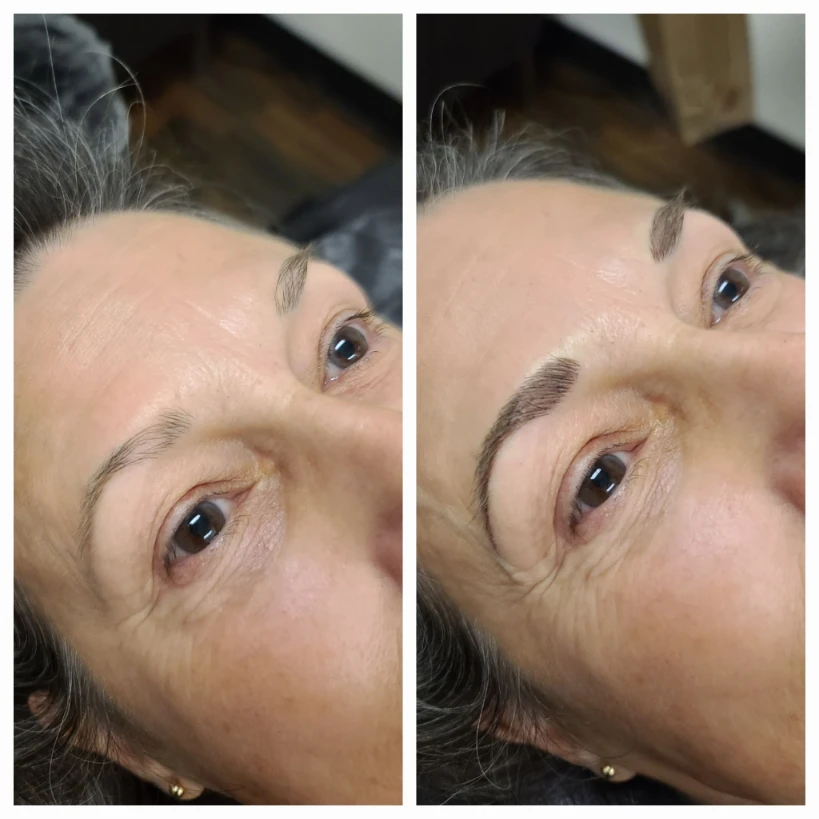 Before and After 11