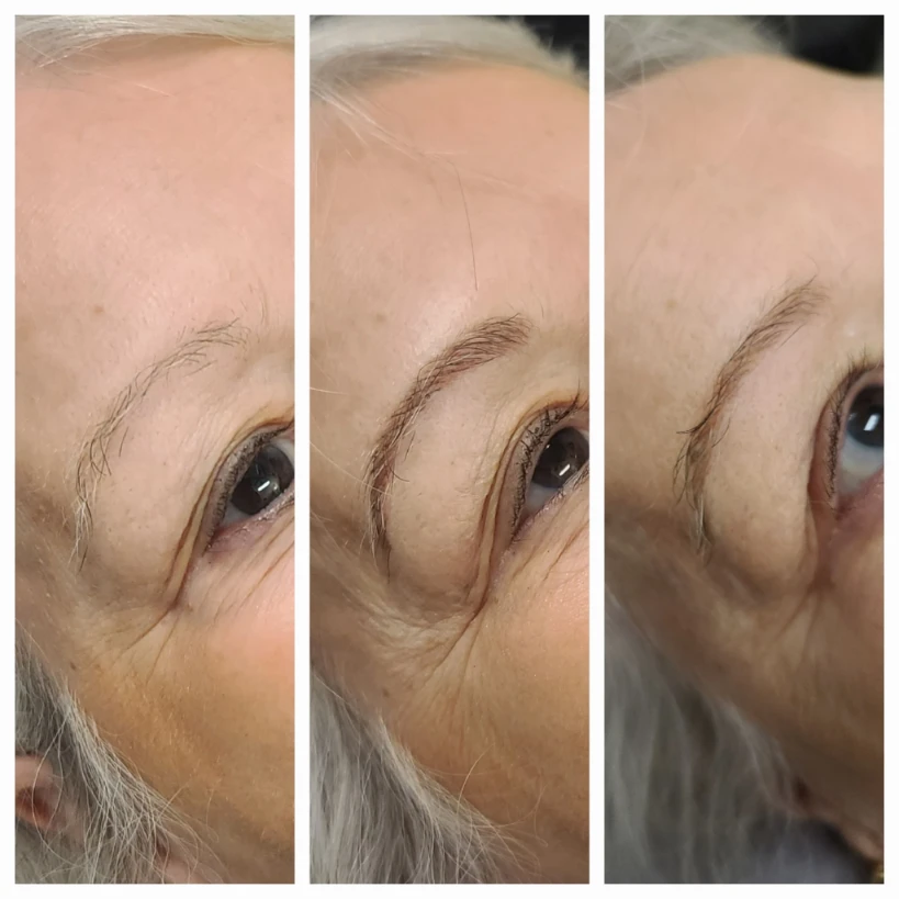 Before and After 3