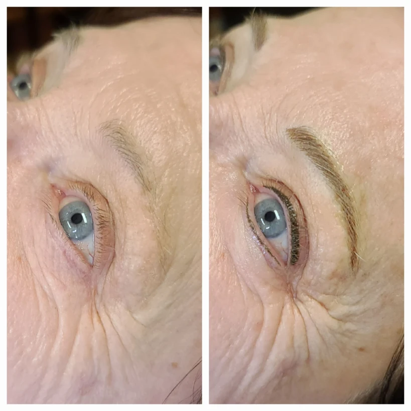 Before and After 1