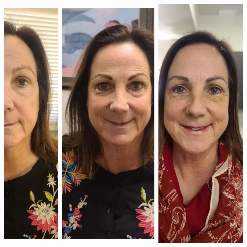 Before and After 23