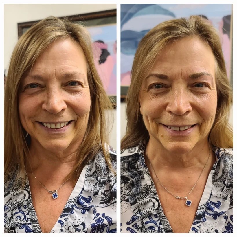 Before and After 22