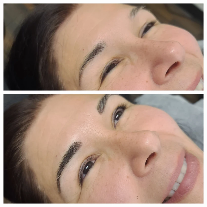 Before and After 6